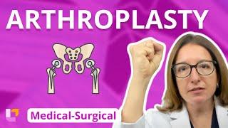 Understanding Arthroplasty: Key Concepts and Nursing Care