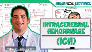 Understanding Intracerebral Hemorrhage